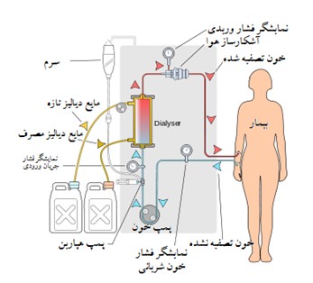 تصوير دياليز چيست